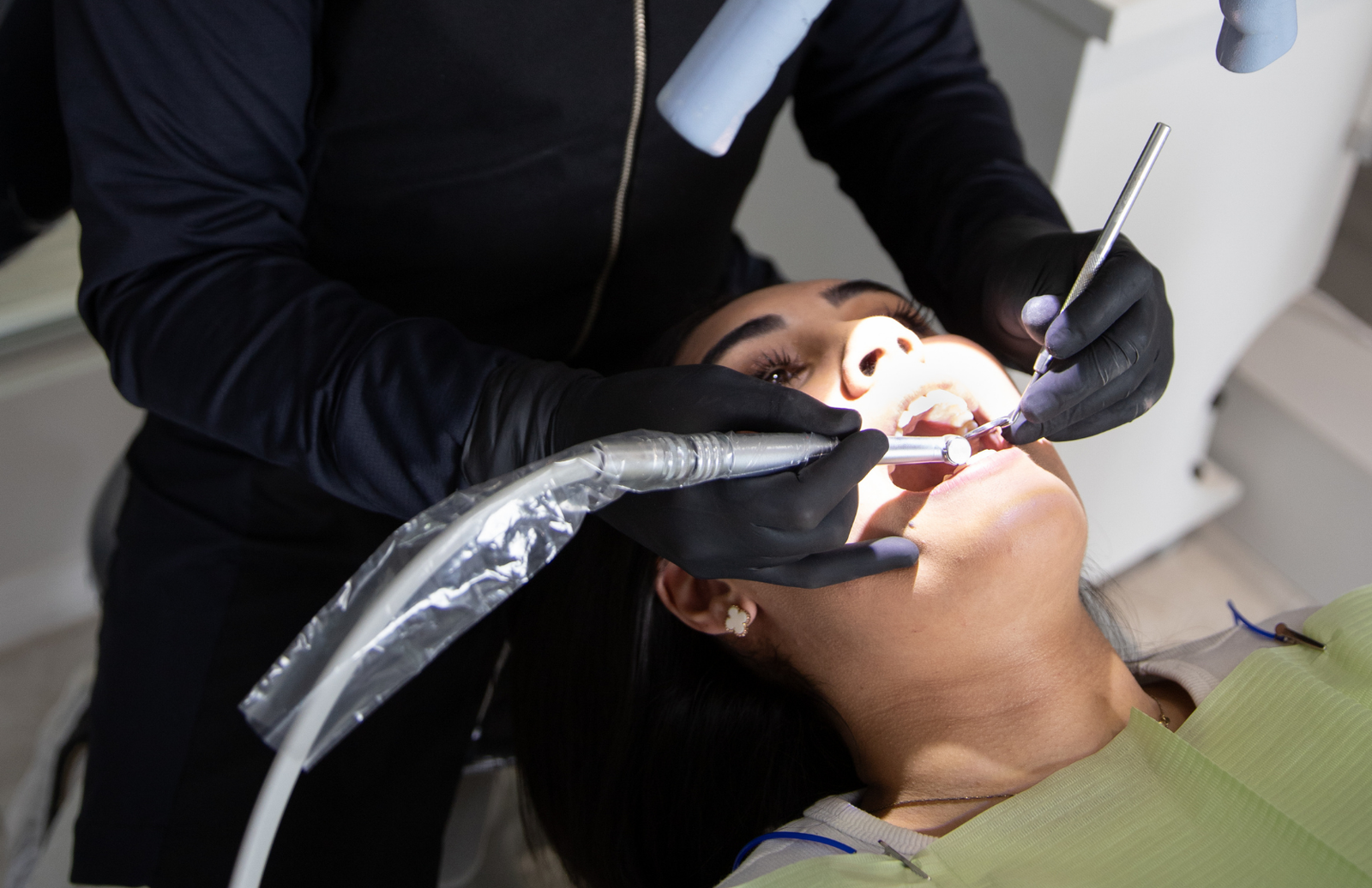 Raspagem na limpeza dental
